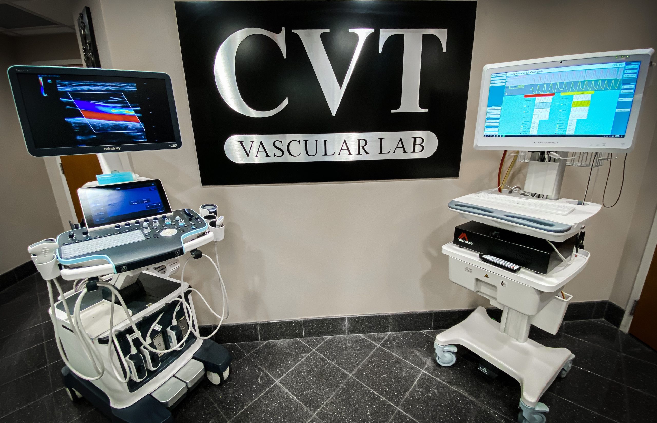 Venous Insufficiency Examination Cvt Vascular Laboratory La 8262